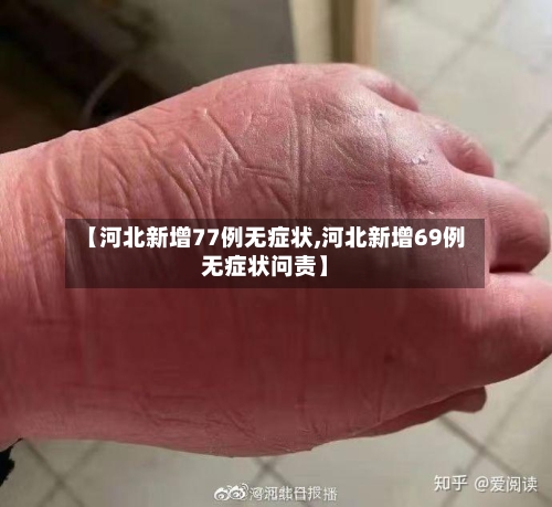 【河北新增77例无症状,河北新增69例无症状问责】-第2张图片